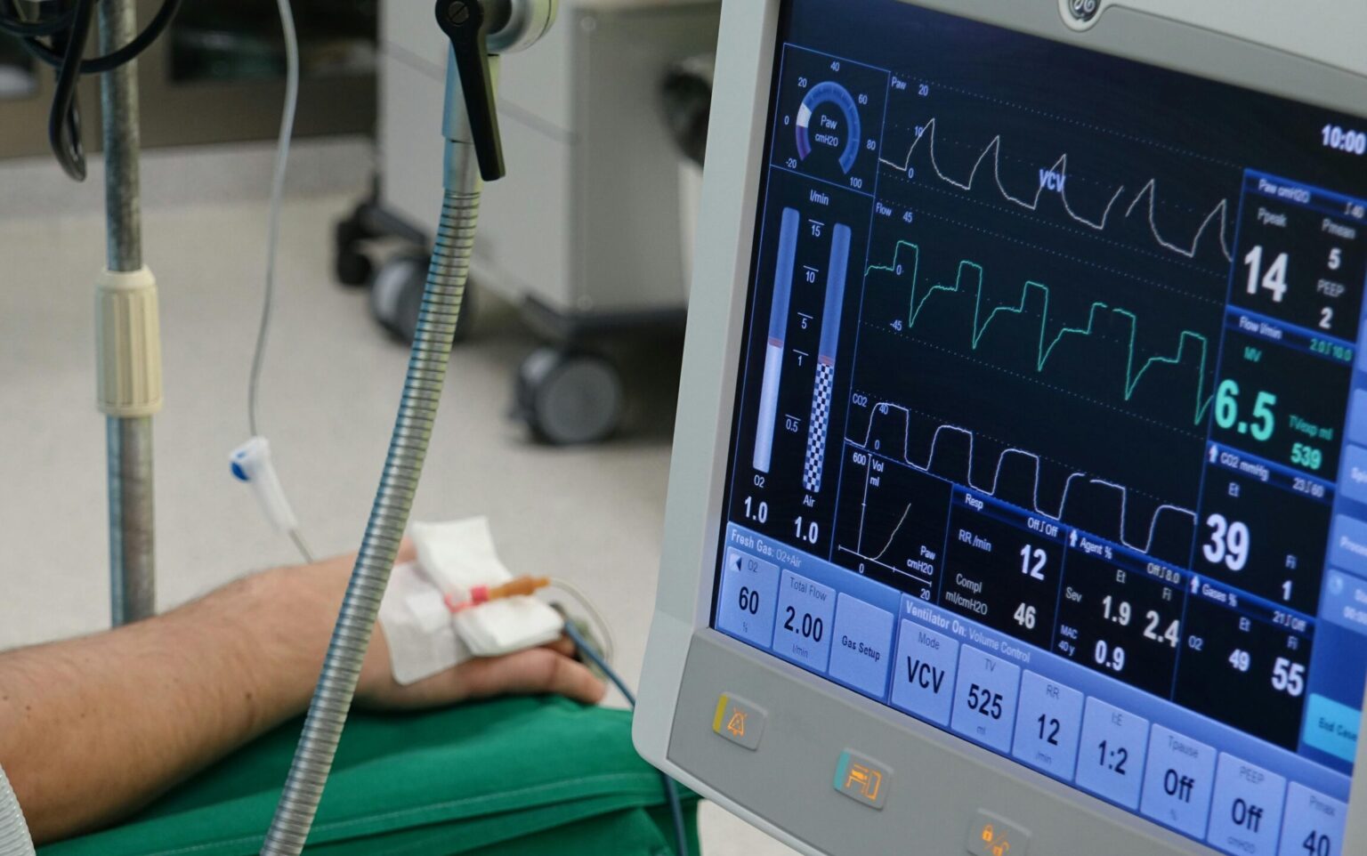 Reggeborgh: Δωρεά ιατροτεχνολογικού εξοπλισμού ύψους 334.658 ευρώ στο Γενικό Νοσοκομείο Κέρκυρας